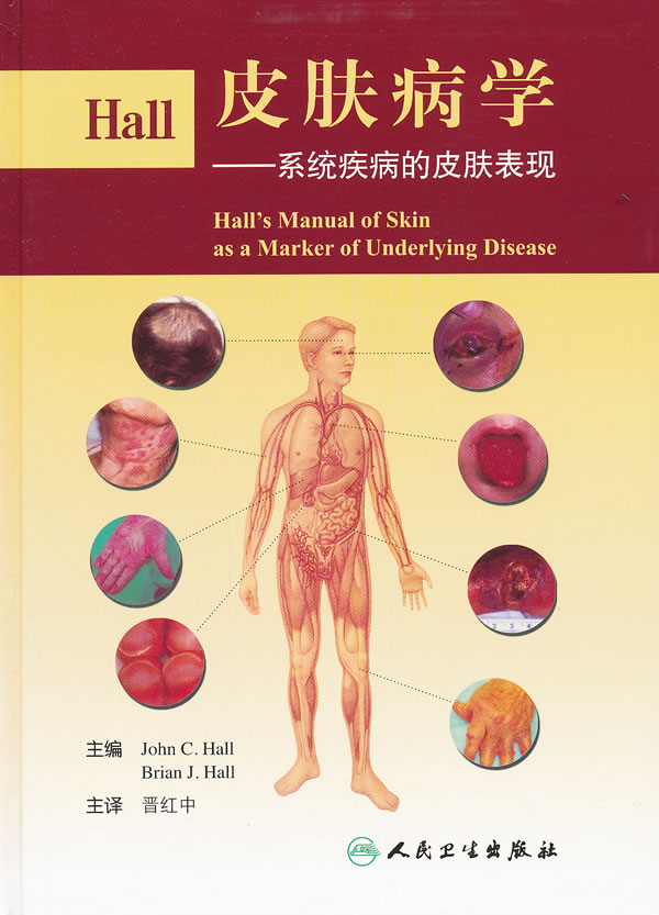 Hall皮肤病学-系统疾病的皮肤表现