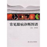 常见眼病诊断图谱