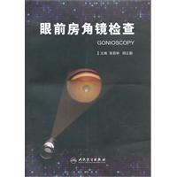 眼前房角镜检查
