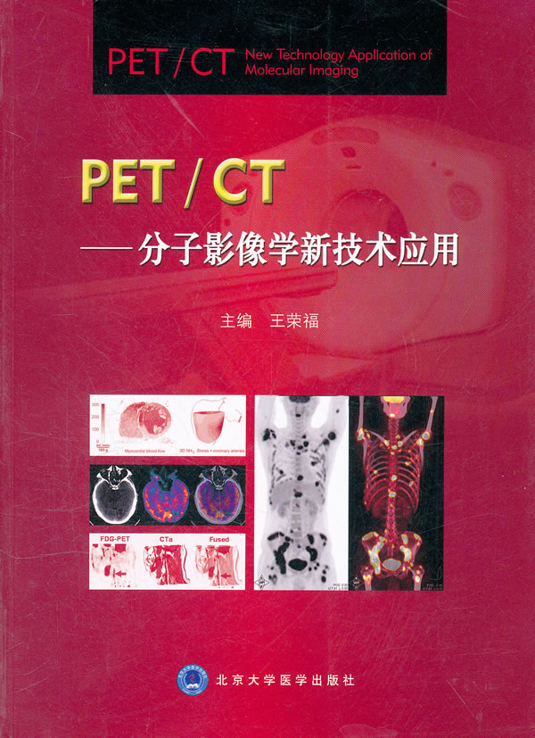 PET/CT分子影像学新技术应用