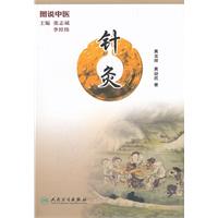 针炙-图说中医