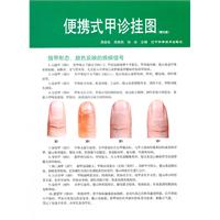 便携式甲诊挂图-(赠光盘)