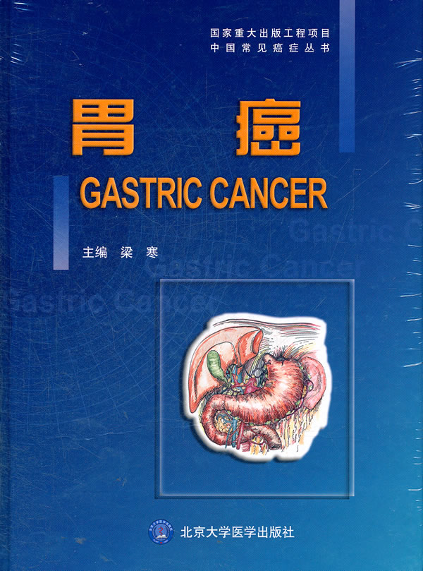 胃癌