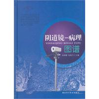 阴道镜-病理图谱