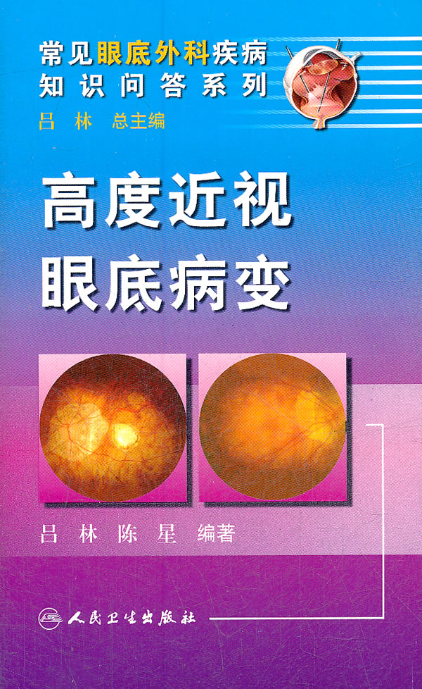 高度近视眼底病变