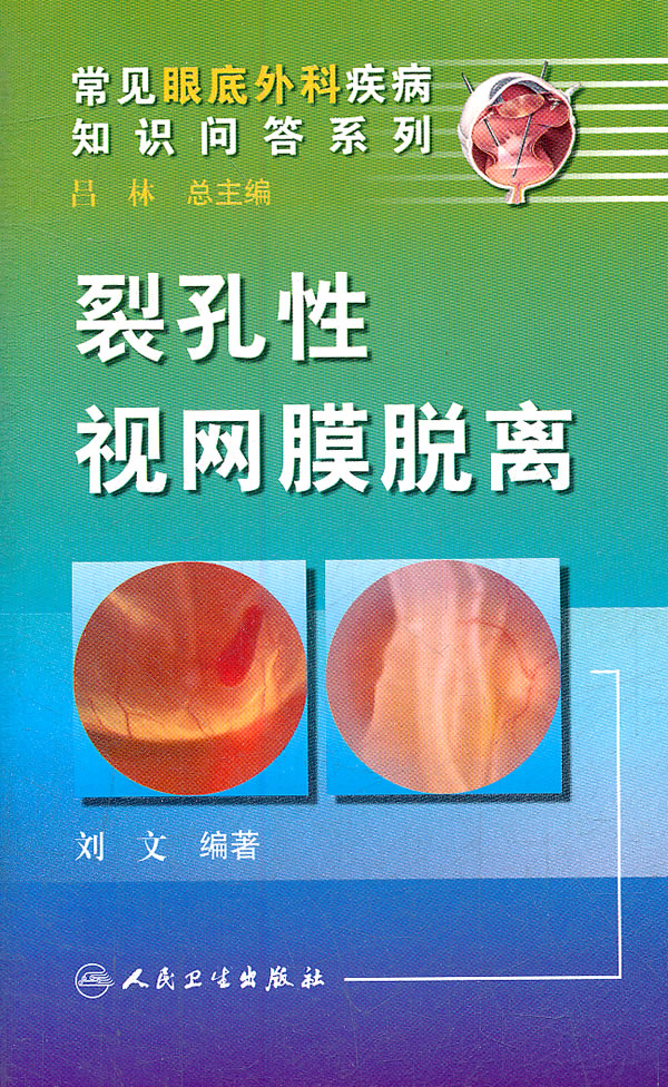 裂孔性视网膜脱离