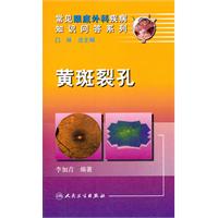 黄斑裂孔