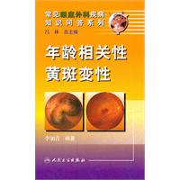 年龄相关性黄斑变性