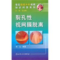 裂孔性视网膜脱离