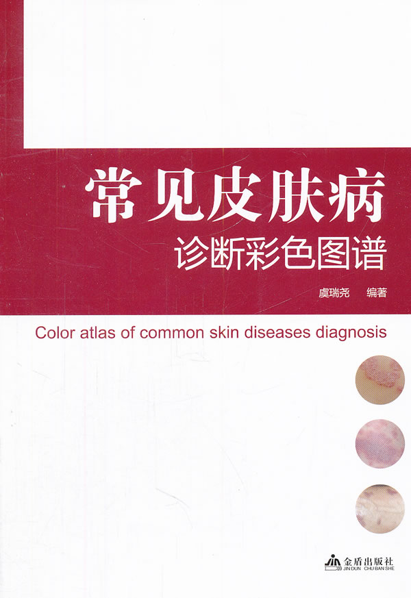 常见皮肤病诊断彩色图谱