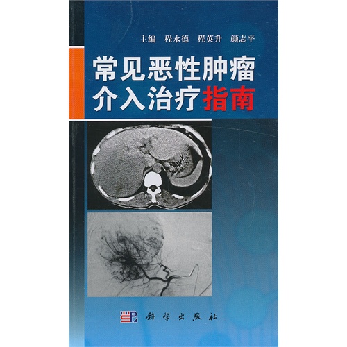 常见恶性肿瘤介入治疗指南