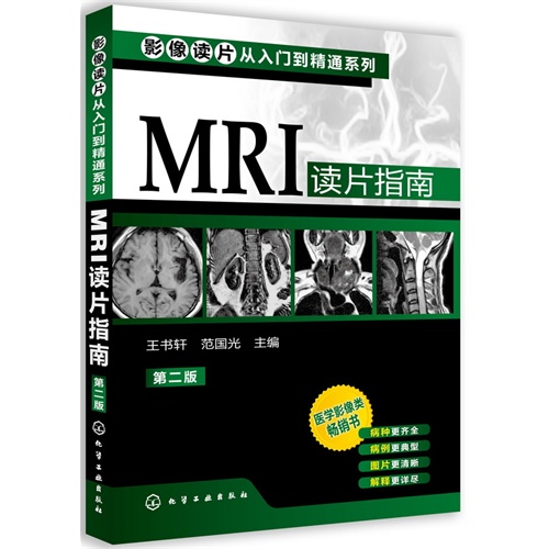 MRI 读片指南-第二版