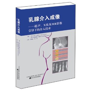 乳腺介入成像-超声.X线及MR影像引导下的介入技术