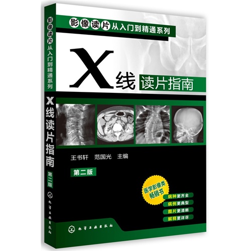 X线读片指南-第二版