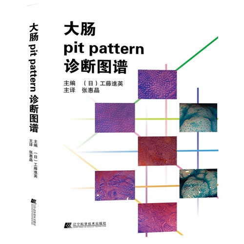 大肠pit pattern诊断图谱