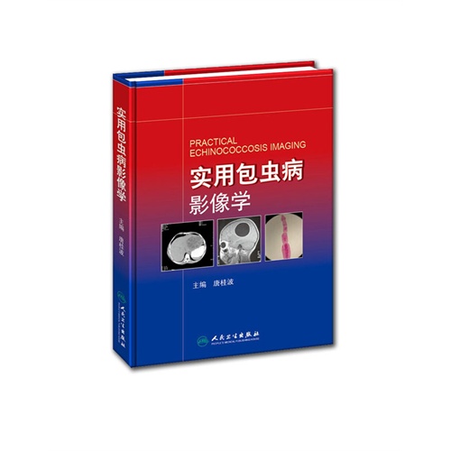 实用包虫病影像学