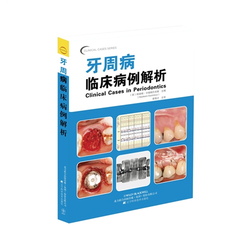 牙周病临床病例解析