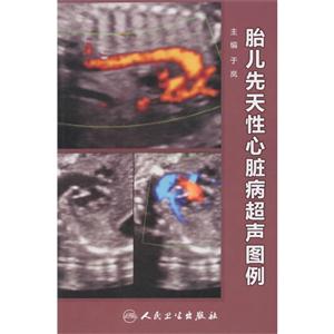 胎儿先天性心脏病超声图例