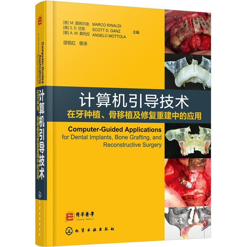 计算机引导技术在牙种植.骨移植及修复重建中的应用