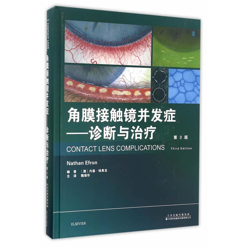 角膜接触镜并发症-诊断与治疗-第3版
