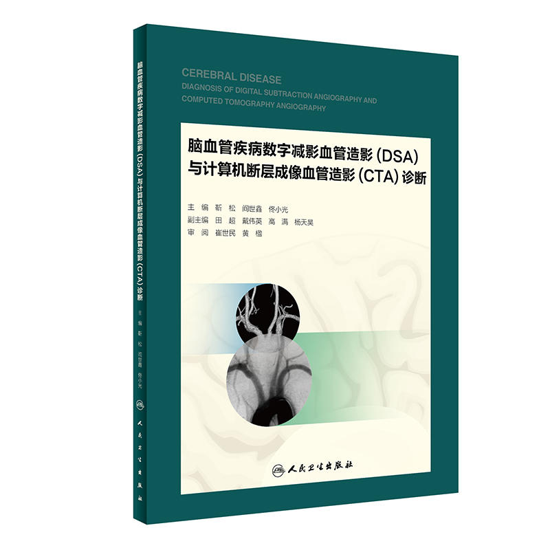 脑血管疾病数字减影血管造影(DSA)与计算机断层成像血管造影(CTA)诊断