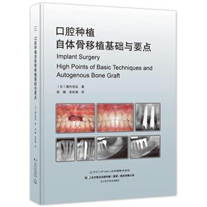 口腔种植自体骨移植基础与要点