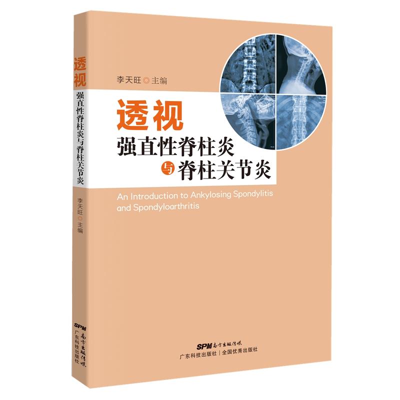 透视强直性脊柱炎与脊柱关节炎