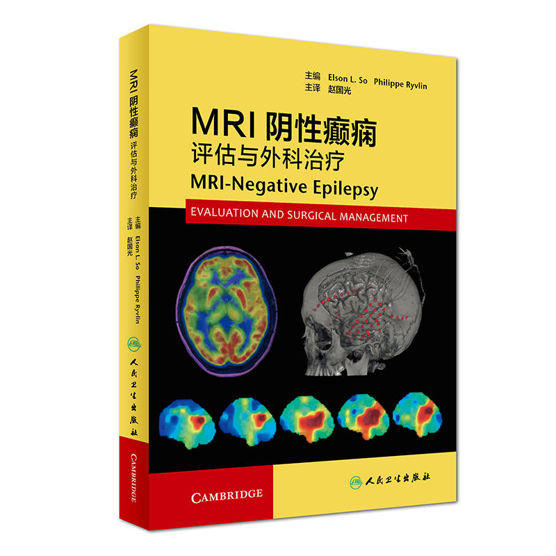 MRI阴性癫痫-评估与外科治疗