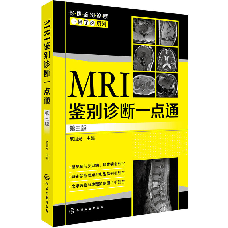 影像鉴别诊断一目了然系列MRI鉴别诊断一点通(第3版)/影像鉴别诊断一目了然系列