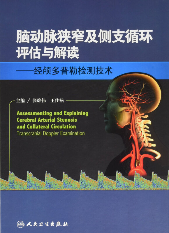 脑动脉狭窄及侧支循环评估与解读-经颅多普勒检测技术