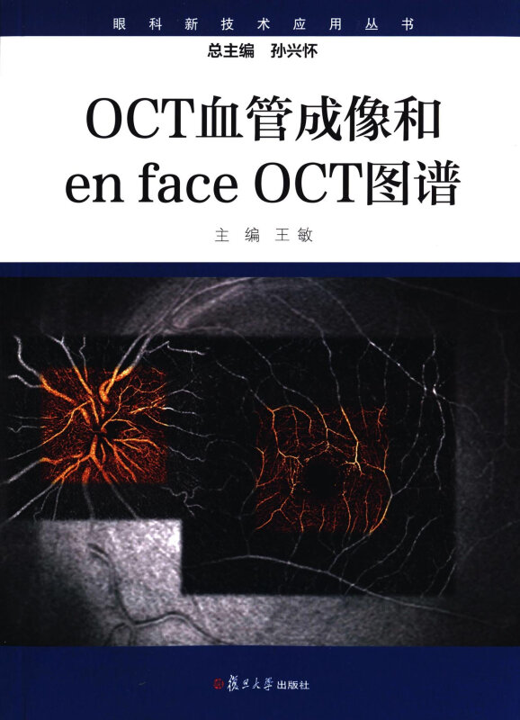 OCT血管成像和en face OCT图谱