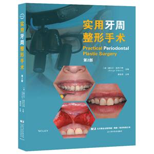 实用牙周整形手术(第2版)