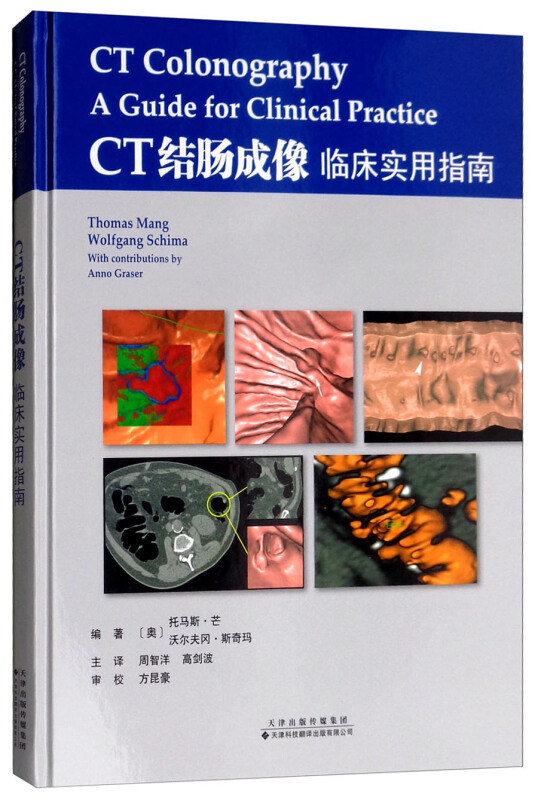 CT结肠成像:临床实用指南
