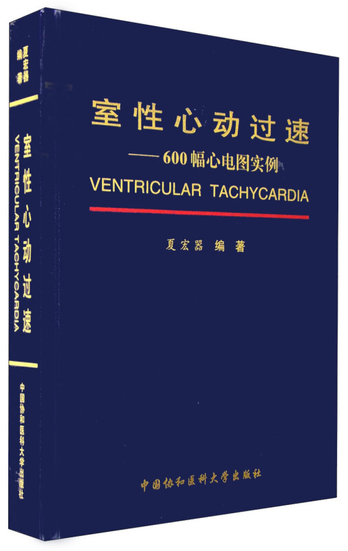 室性心动过速-600幅心电图实例