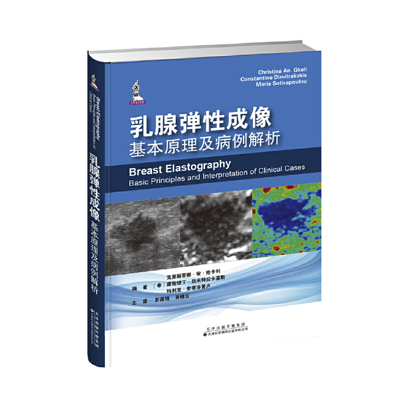 乳腺弹性成像:基本原理及病例解析