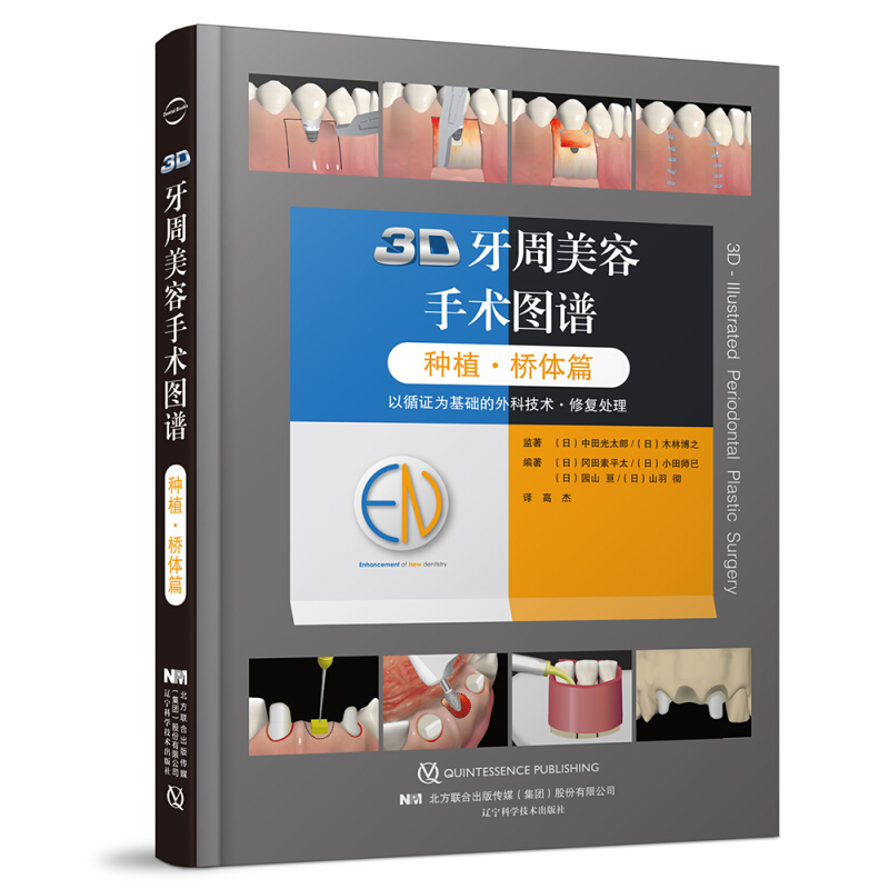 3D牙周美容手术图谱:种植.桥体篇