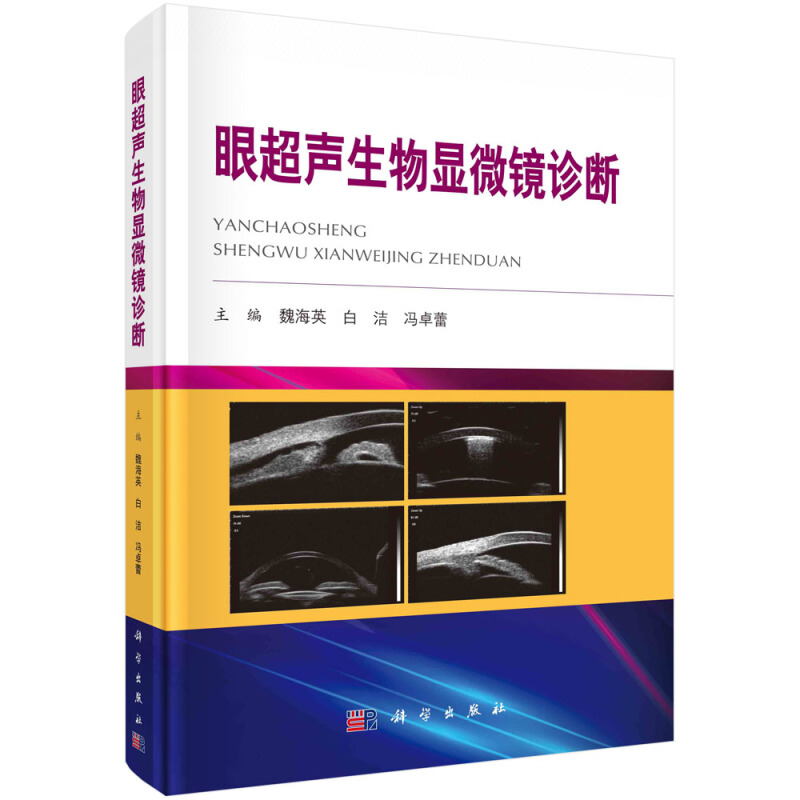 眼超声生物显微镜诊断::::