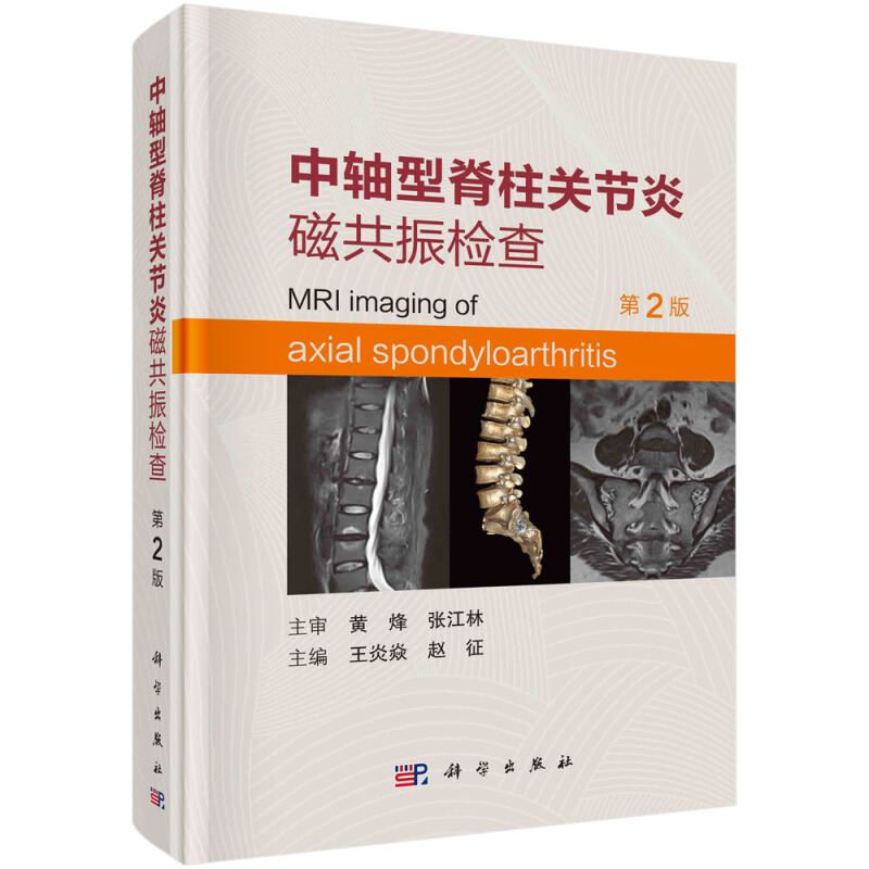 中轴型脊柱关节炎磁共振检查(第2版)(精)
