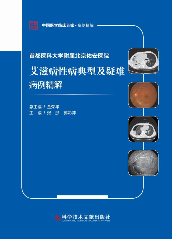 首都医科大学附属北京佑安医院艾滋病性病典型及疑难病例精解