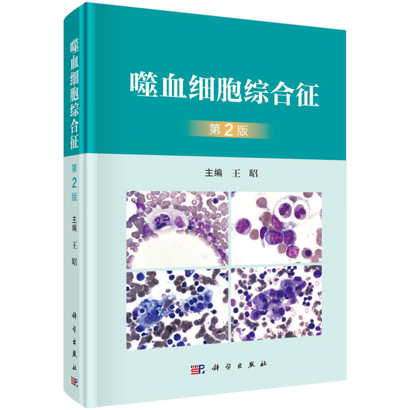 噬血细胞综合征(第2版)