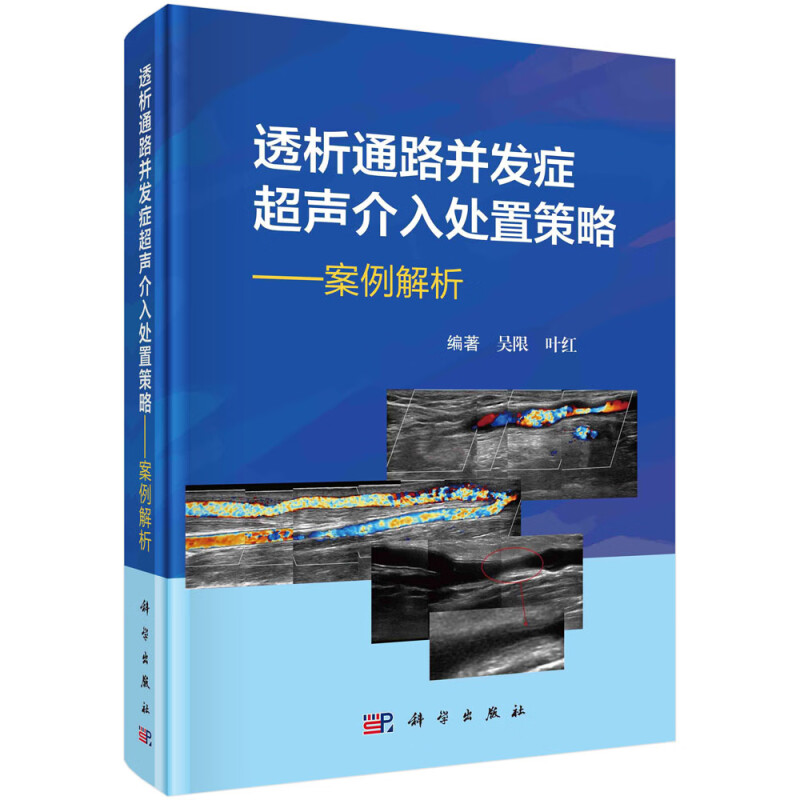 透析通路并发症超声介入处置策略——案例解析