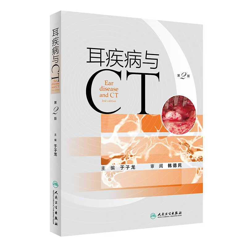 耳疾病与CT(第2版)(精)