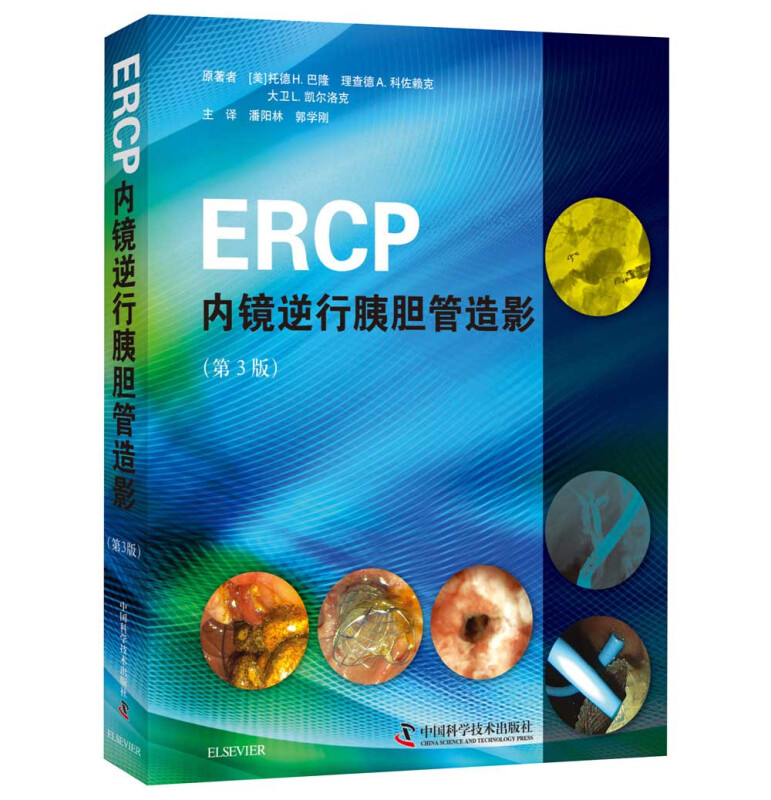 ERCP内镜逆行胰胆管造影