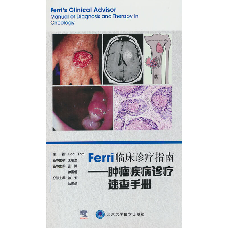 FERRI临床诊疗指南——肿瘤疾病诊疗速查手册