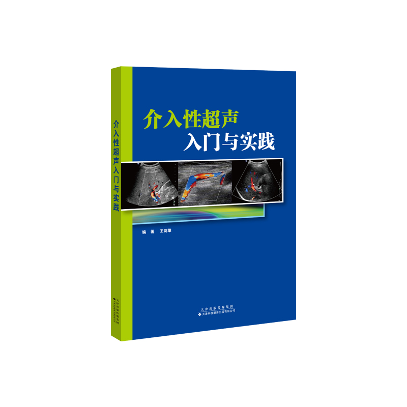 介入性超声入门与实践