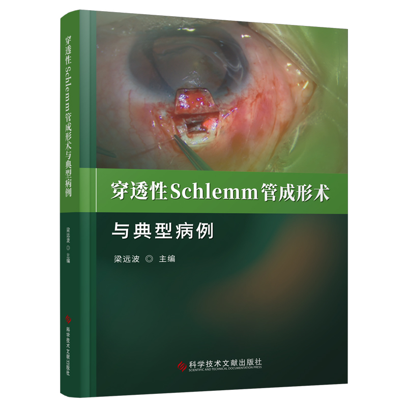 穿透性SCHLEMM管成形术与典型病例