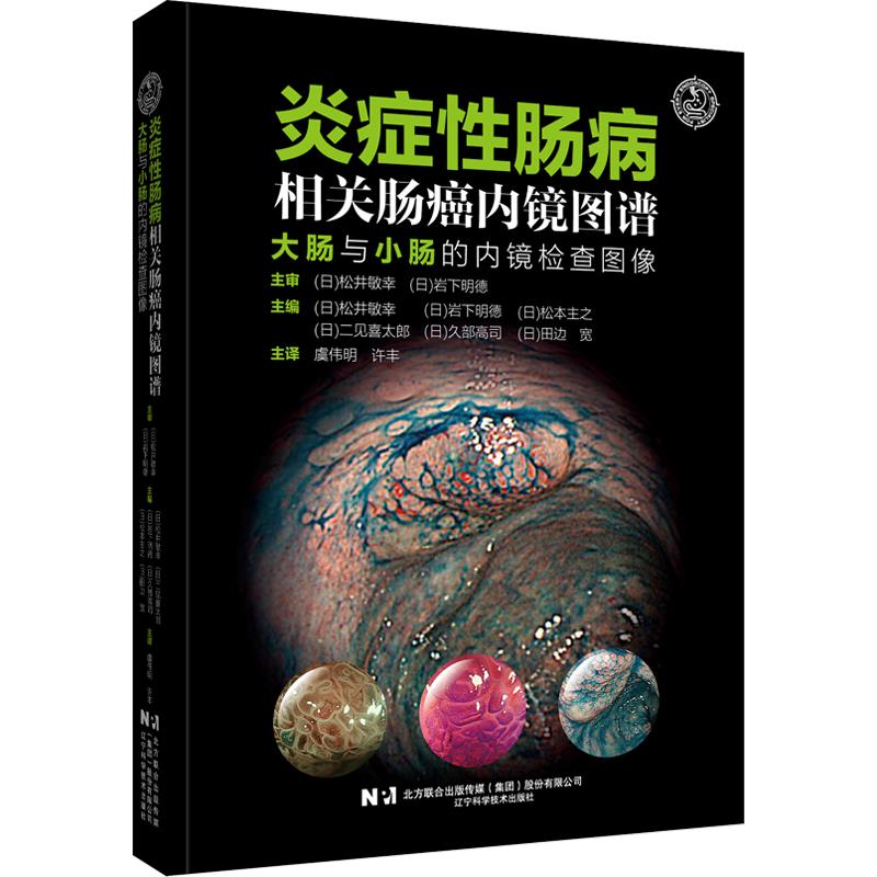 炎症性肠病:相关肠癌内镜图谱大肠与小肠的内镜检查图像