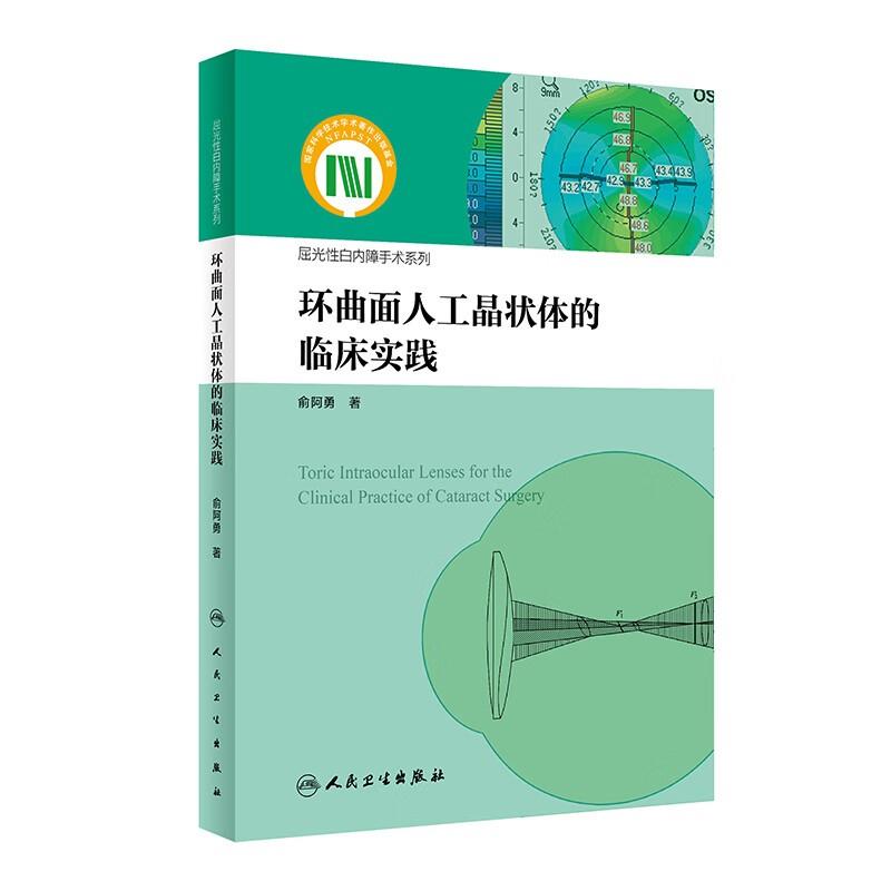 环曲面人工晶状体的临床实践(屈光性白内障手术系列)