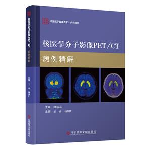 ҽѧӰPET/CT