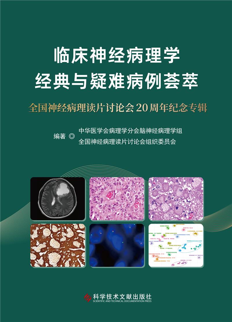 临床神经病理学经典与疑难病例荟萃--全国神经病理读片讨论会20周年纪念专辑